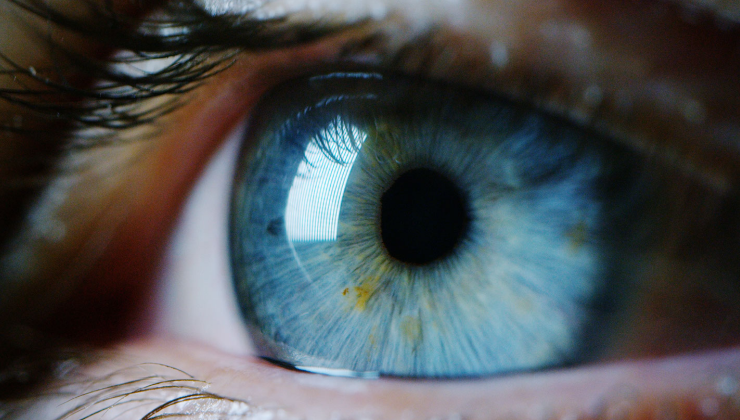 A close up of a person's blue eye at an eye clinic in Abuja.