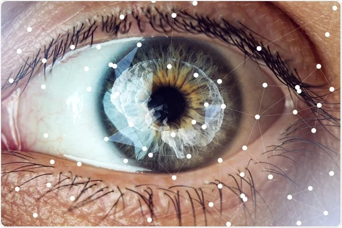 A close up of a person's eye with dots on it.